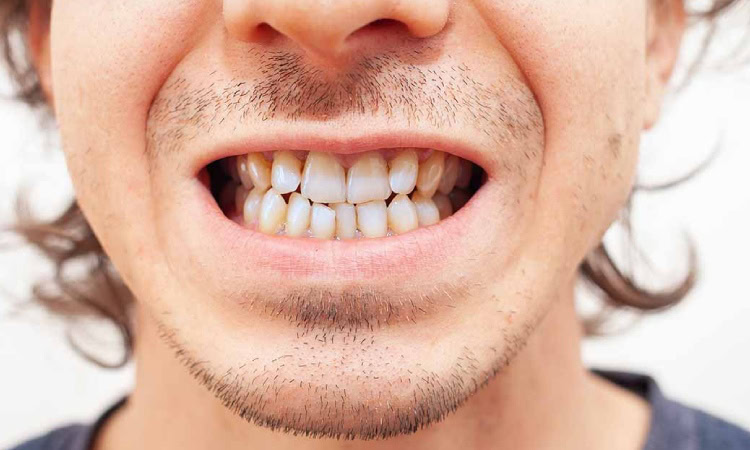 Keunikan dari gigi manusia, Sumber: brunswickdentalgroup.com.au