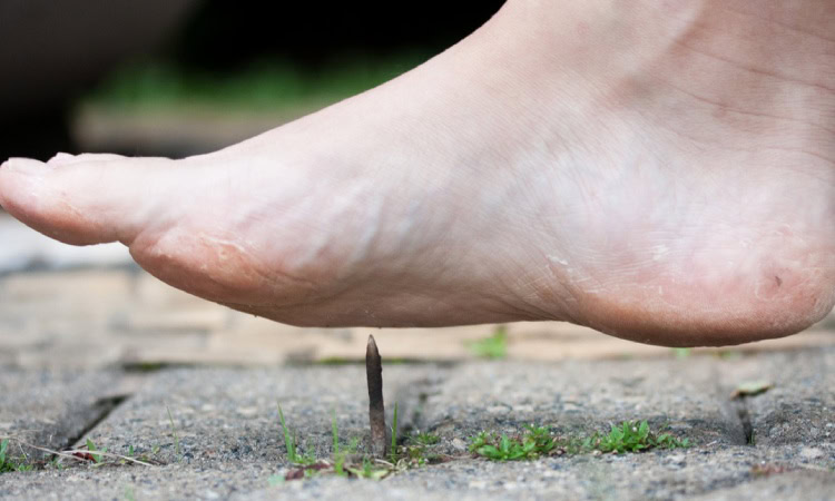 Penyakit tetanus, Sumber: klikdokter.com