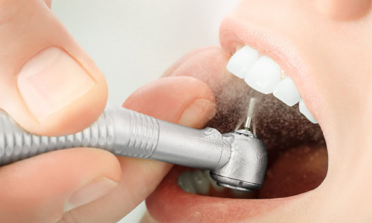 Manfaat melakukan dental spa, Sumber: dentistryonelgin.com