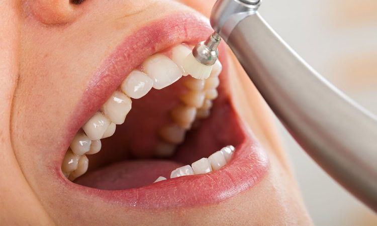 Mengenal dental spa, Sumber: cinikdental.com
