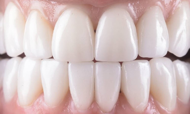 Ciri-ciri gigi yang sehat, Sumber: directdental.co.uk