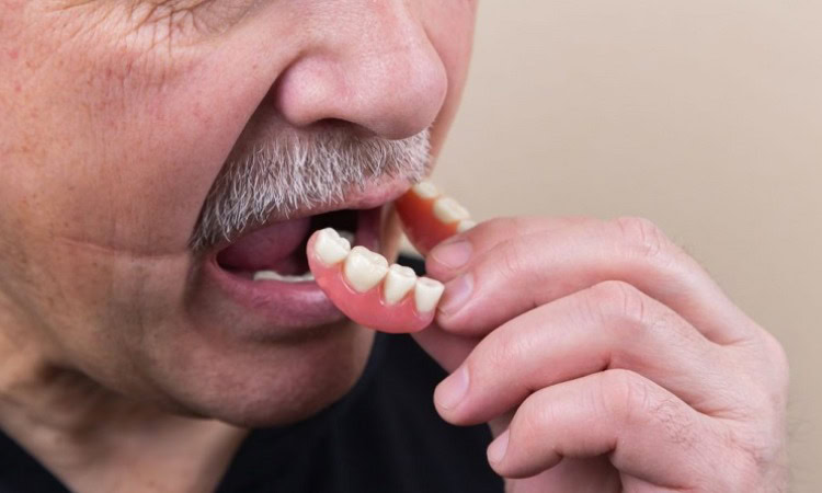 Mengatasi gigi yang ompong, Sumber: klinikjoydental.com