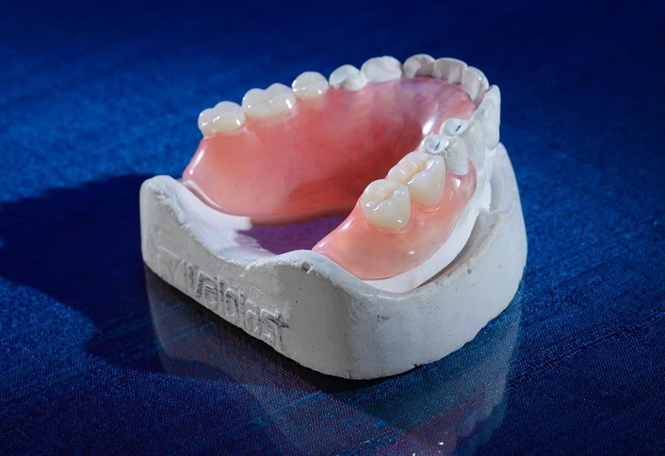 Mengenal lebih dalam mengenai gigi tiruan valplast, Sumber: burbankdental.com