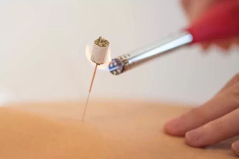 Acupuncteur Yens | Aline Max Acupuncture | MTC