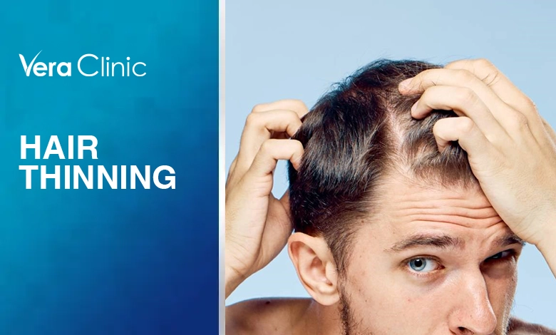 A Comprehensive Guide To Hair Thinning a-comprehensive-guide-to-hair-thinning