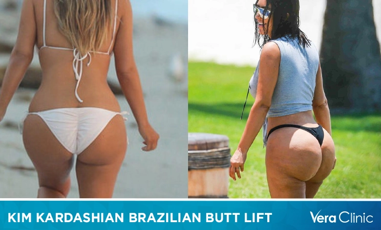 Kim Kardashian Brazilian Butt Lift: Fact or Fiction?