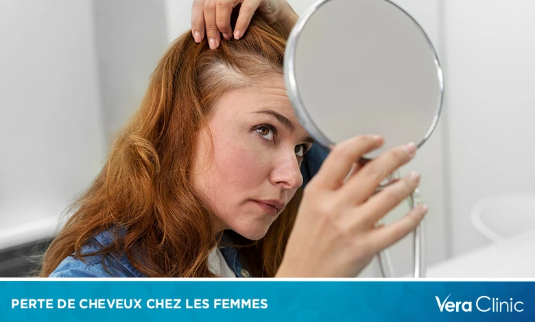 Perte de cheveux chez les femmes