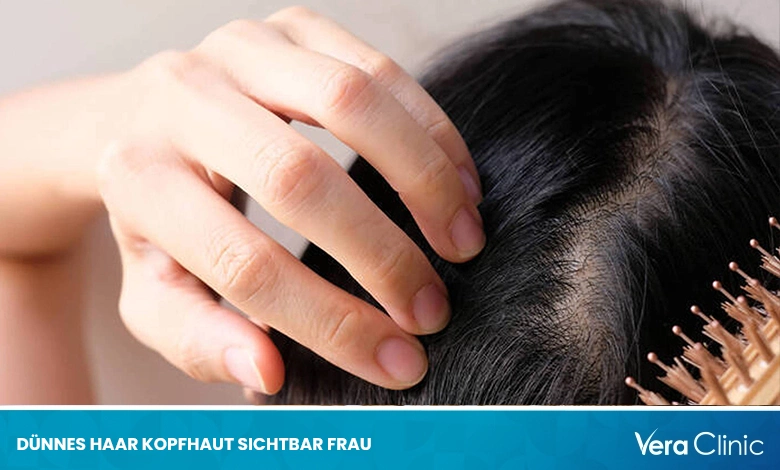 Dünnes Haar Kopfhaut Sichtbar Frau