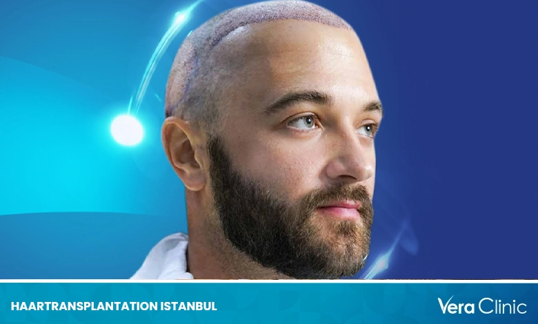 Haartransplantation Istanbul