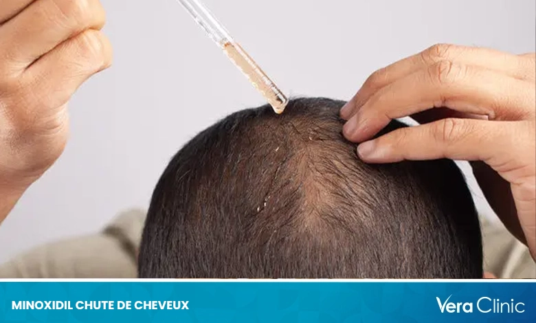 Minoxidil cheveux