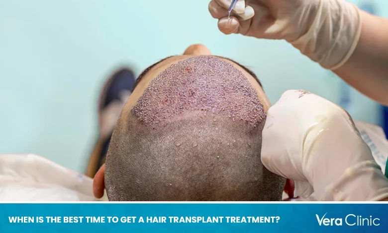 When is the Best Time to Get a Hair Transplant Treatment?