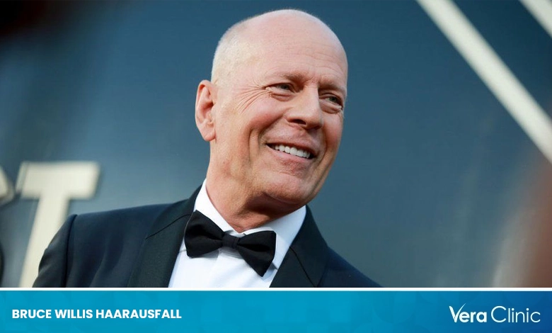 Bruce Willis Haarausfall