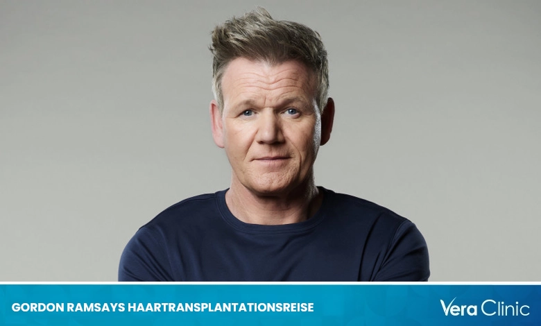 Gordon Ramsays Haartransplantationsreise - VeraClinic