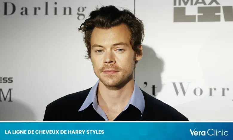 La Ligne de Cheveux de Harry Styles