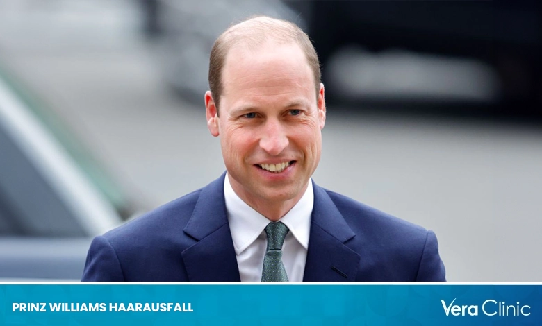 Prinz Williams Haarausfall