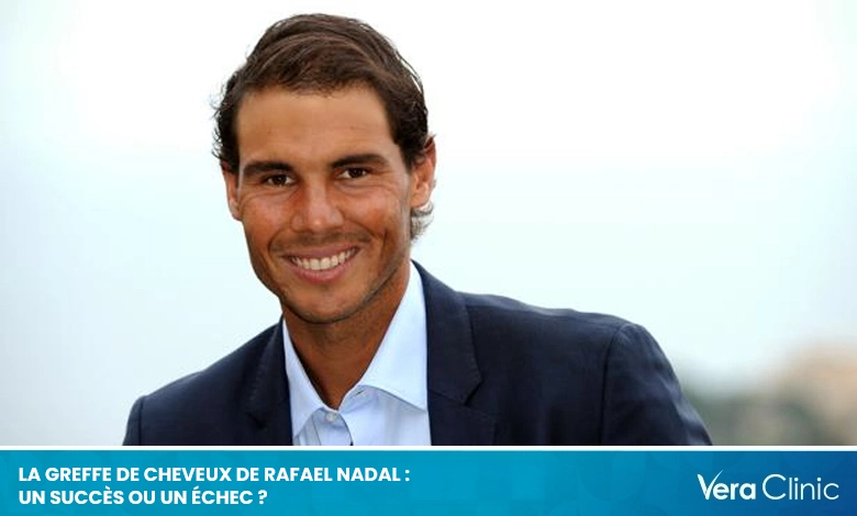 La greffe de cheveux de Rafael Nadal