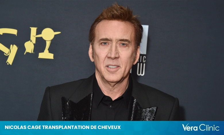 Nicolas Cage Transplantation de Cheveux