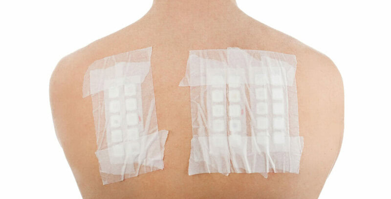 dettaglio di un patch test eseguito per le allergie cutanee