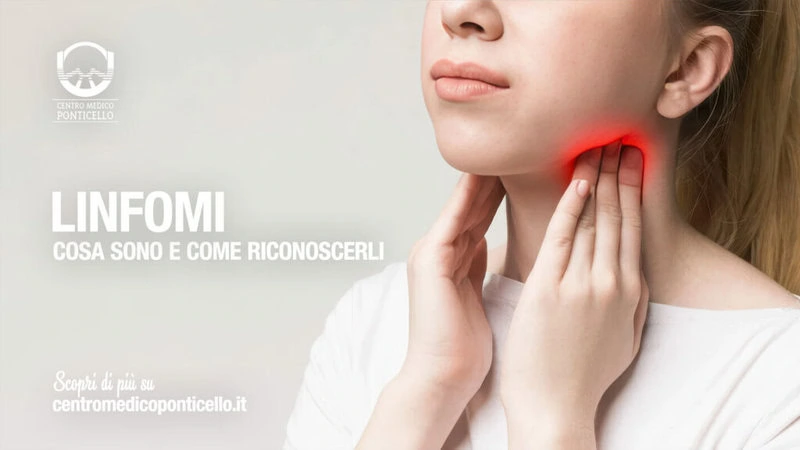 linfomi-come-riconoscerli-centro-medico-ponticello-massa-header