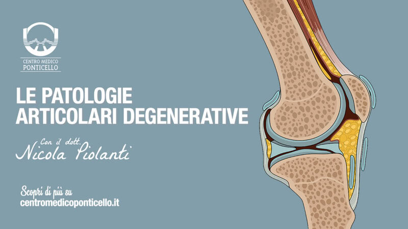 patologie-articolari-degenerative-dolori-articolari-dott-nicola-piolanti-wide