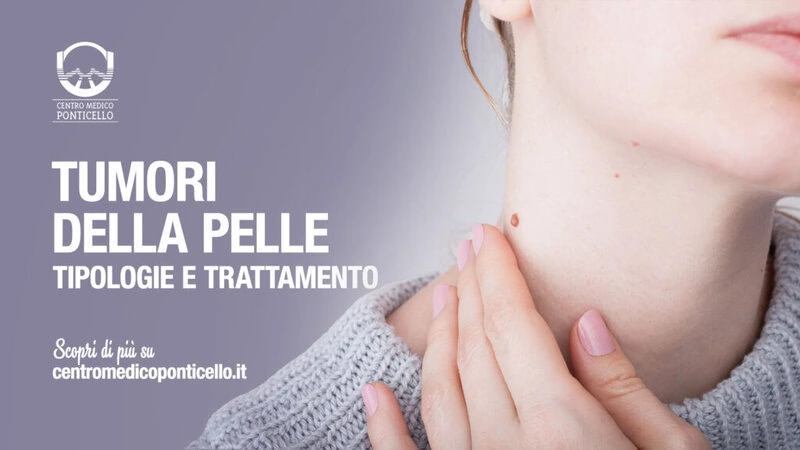 tumori-della-pelle-tipologie-trattamento