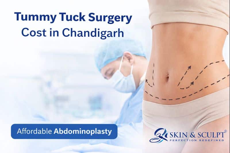 Read more about the article Tummy Tuck Surgery Cost in Chandigarh: Procedure, Recovery, Clinics & Affordable Options