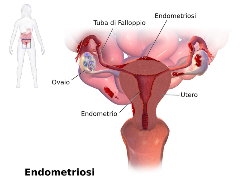 endometriosi-cura-pavimento-pelvico-ponticello-anatomia