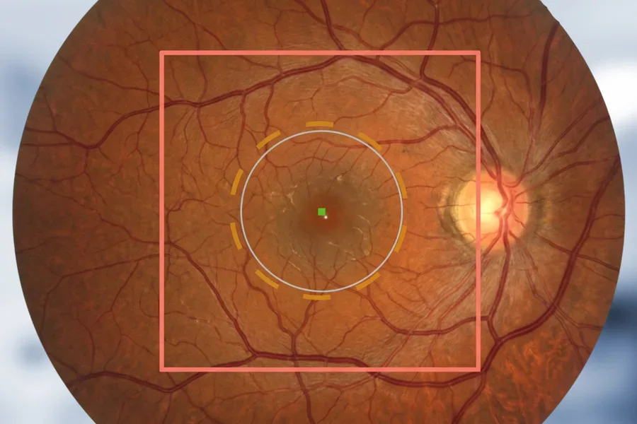 Real-Time Retinal Feedback