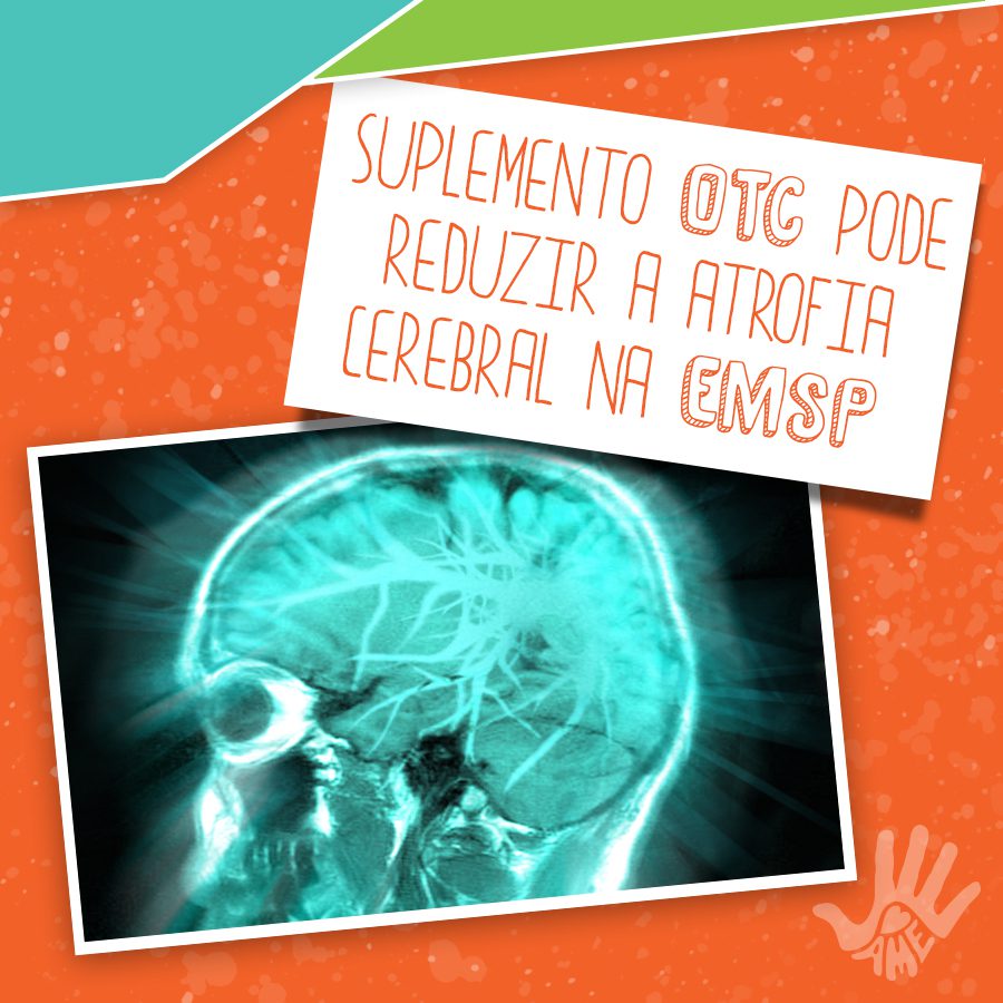 Suplemento Otc Pode Reduzir A Atrofia Cerebral Na Emsp Ame Amigos Multiplos Pela Esclerose