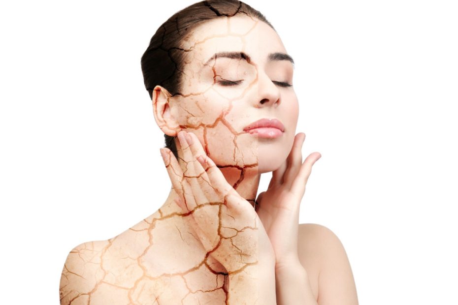 A fotón egy nő látható, akinek abőre nagyon száraz, repedezett.
