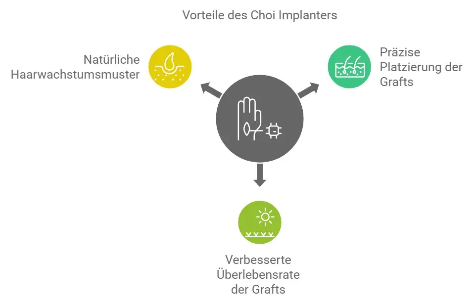 Fortschrittliche Choi-Implantationstechnologie