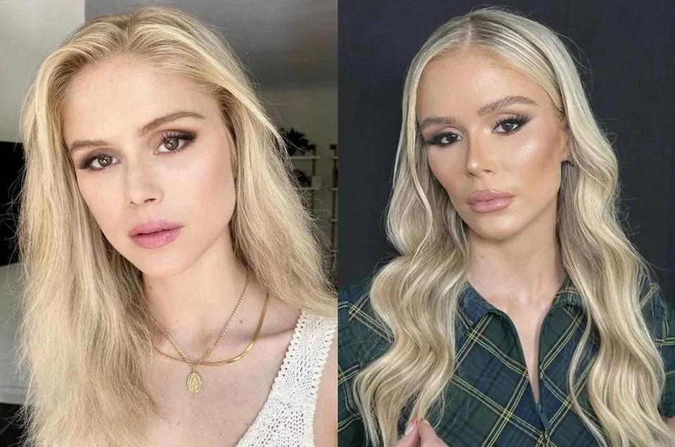 Erin Moriarty's Nose: Before and After