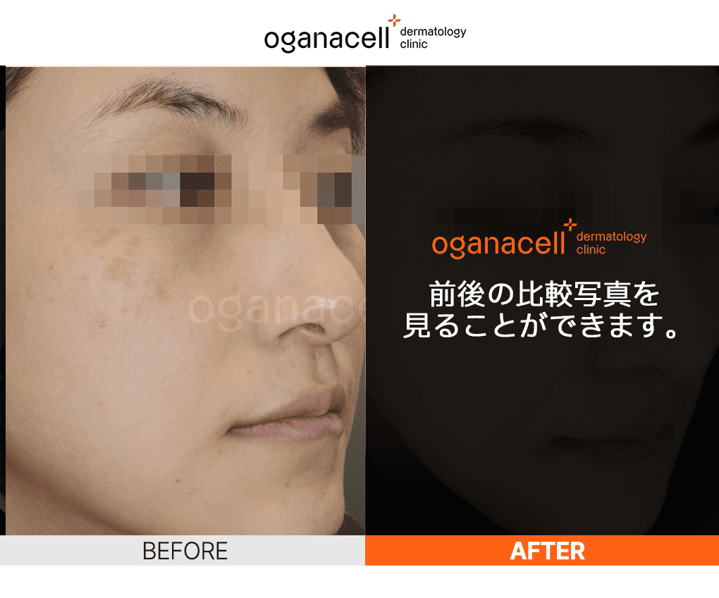 oganaskin 03