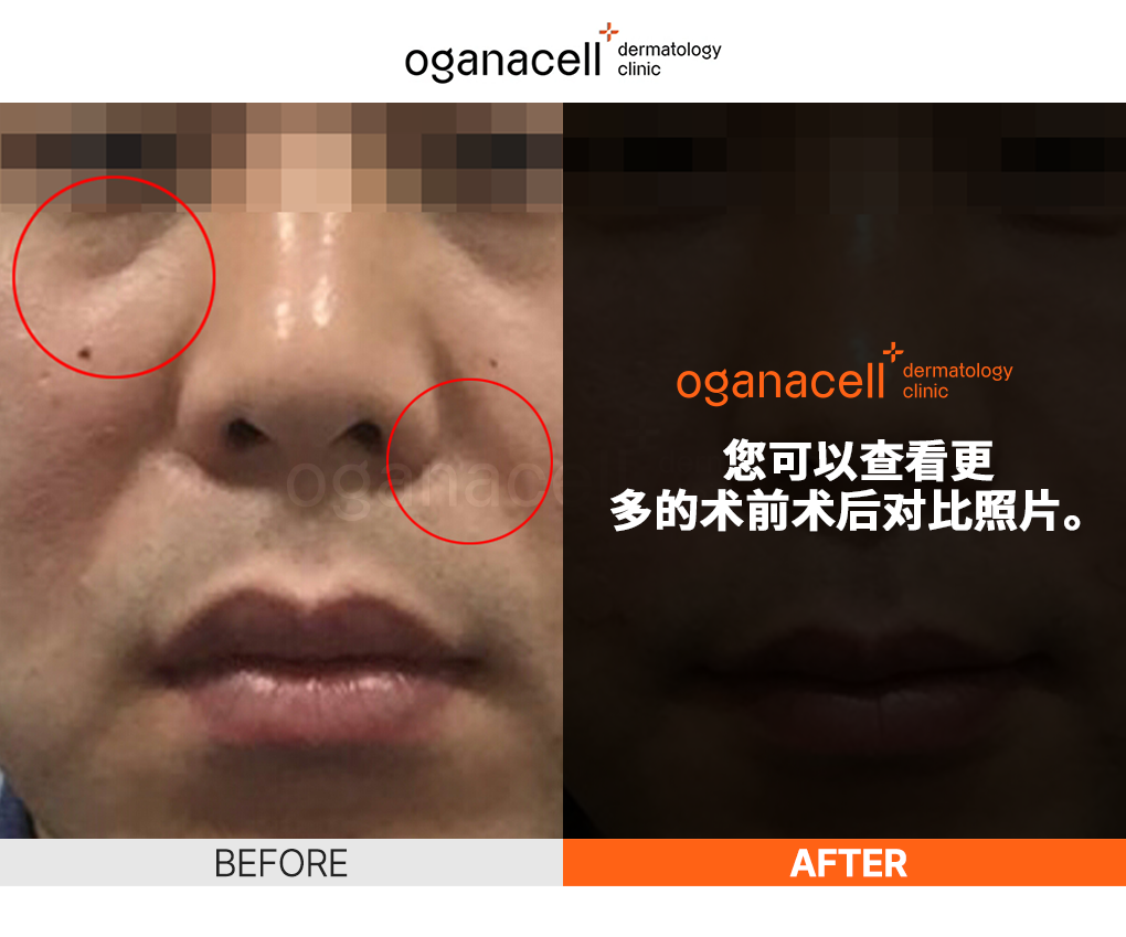 皮肤科皮肤管理前后对比图片