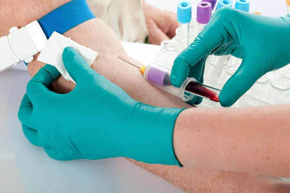 Tips To Make A Blood Draw More Convenient