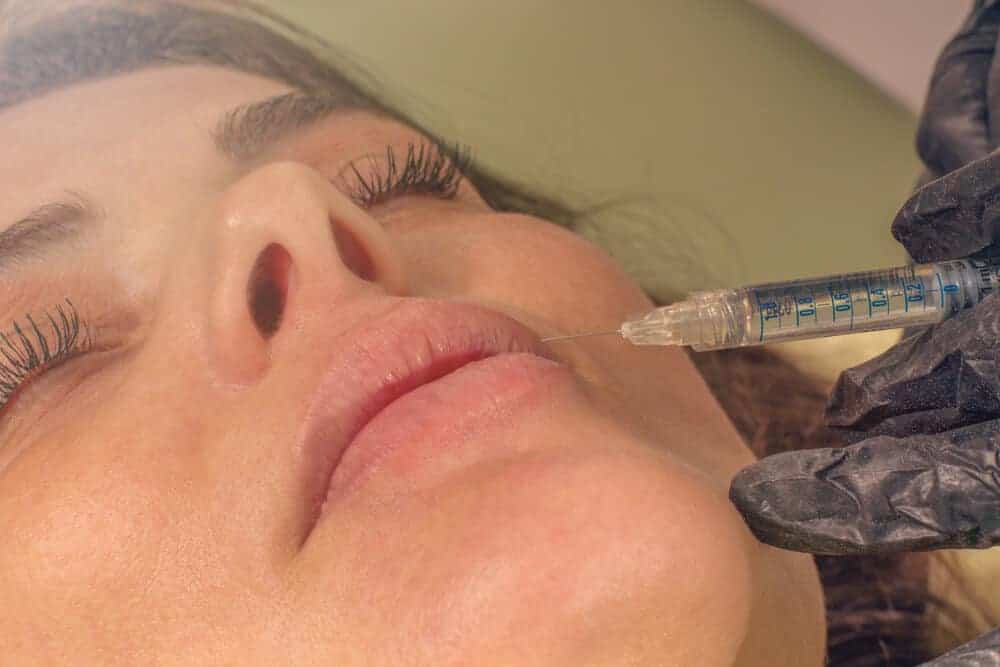 How Lip Fillers Can Help Enhance Your Overall Beauty