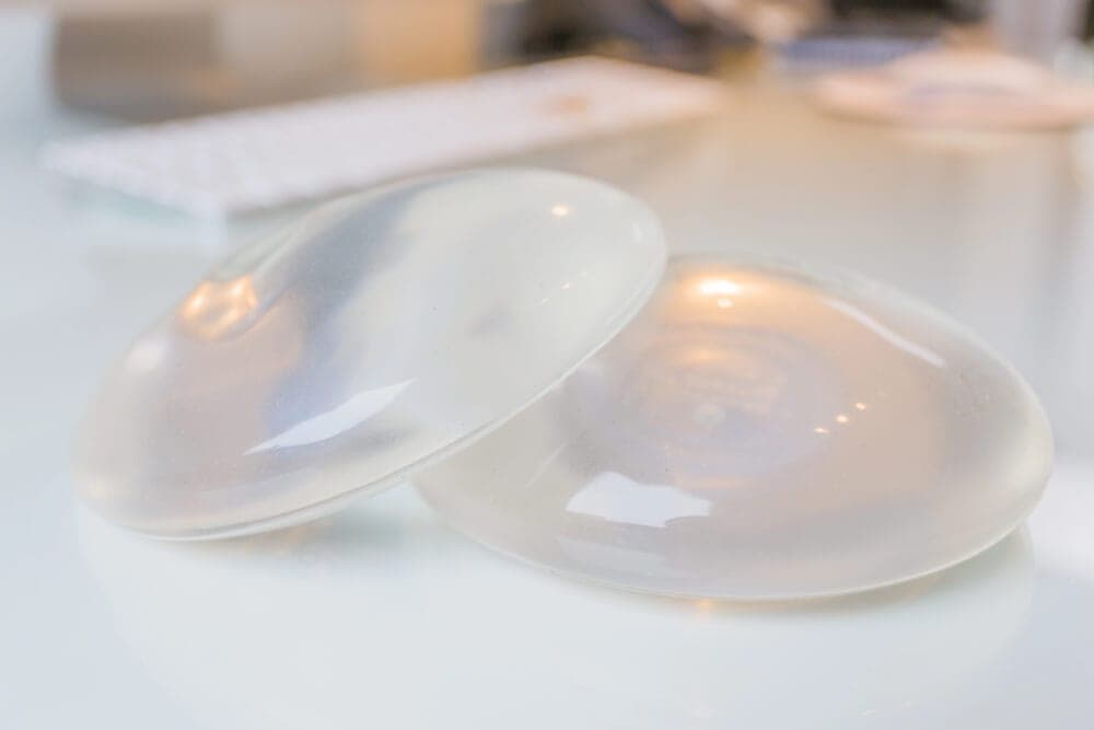 How Do Surgeons Decide Implant Placement? 6 Factors Behind the Decision