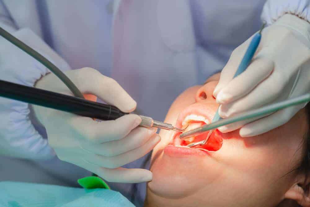 What Does Oral Surgery Include? 6 Common Procedures Explained