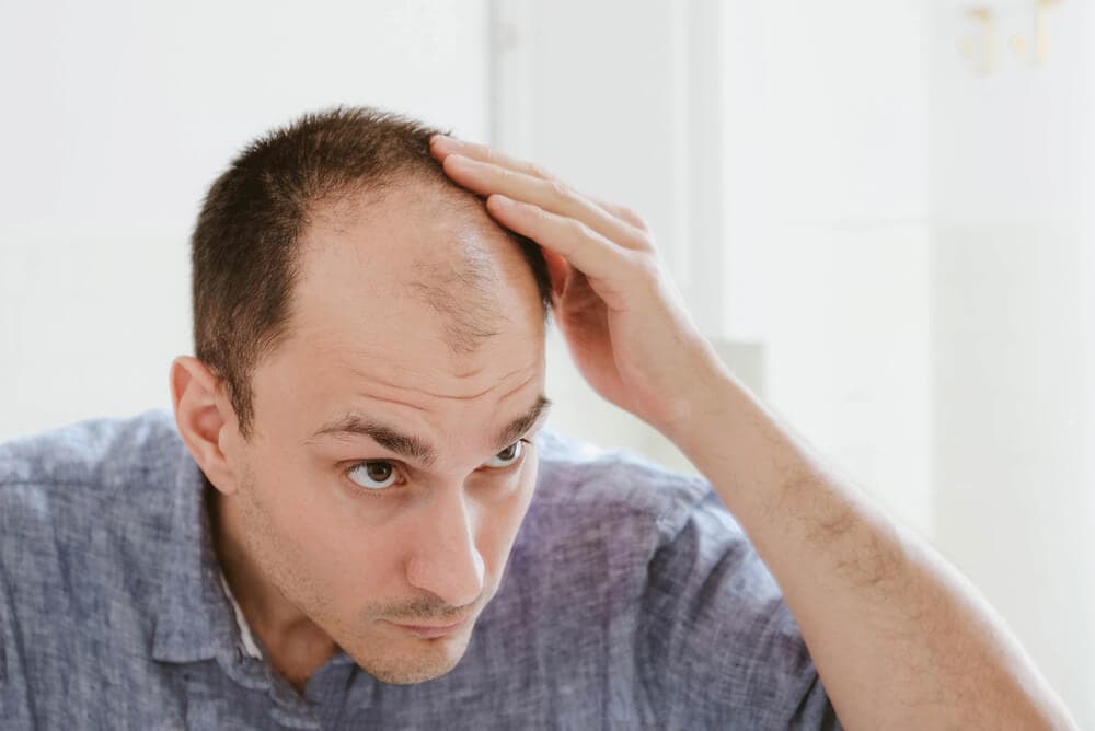 What I Wish Someone Told Me Before I Chose a Hair Transplant