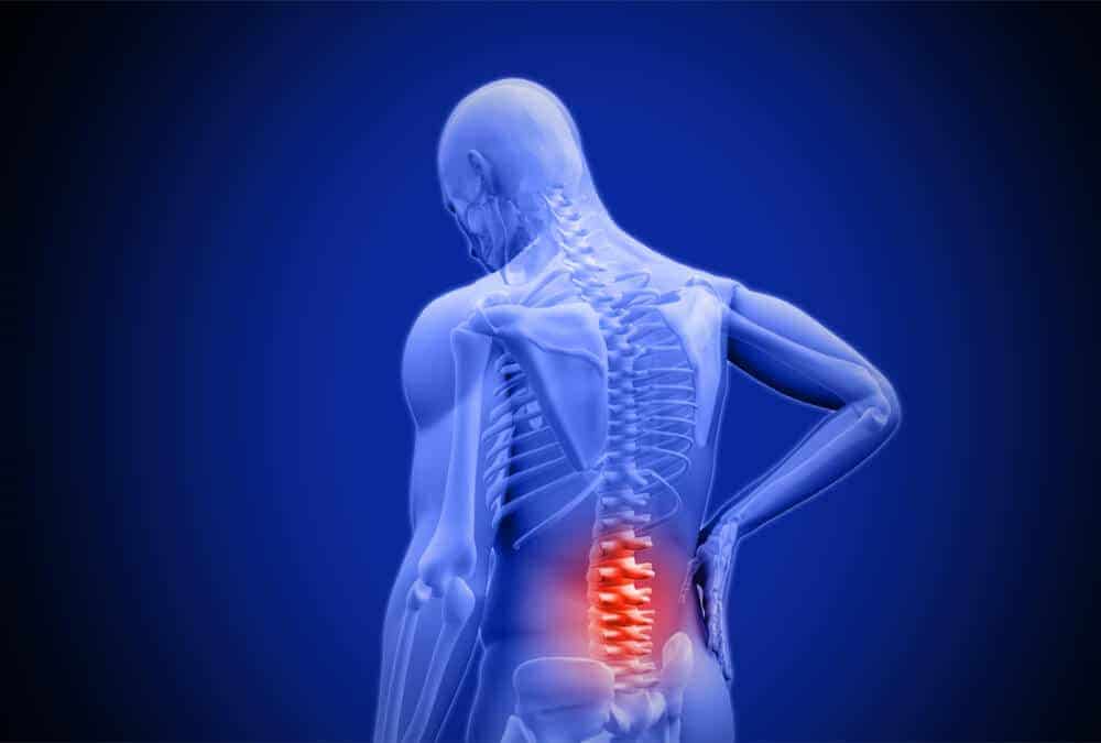 7 Tips to Straighten Your Back Naturally