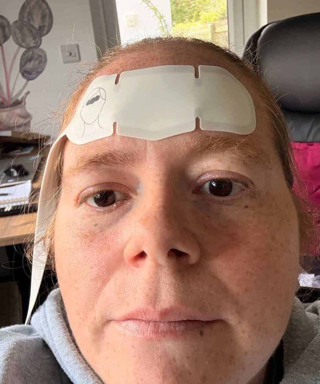 Viforme RF Microcurrent Anti-aging Face Lifting Device Review