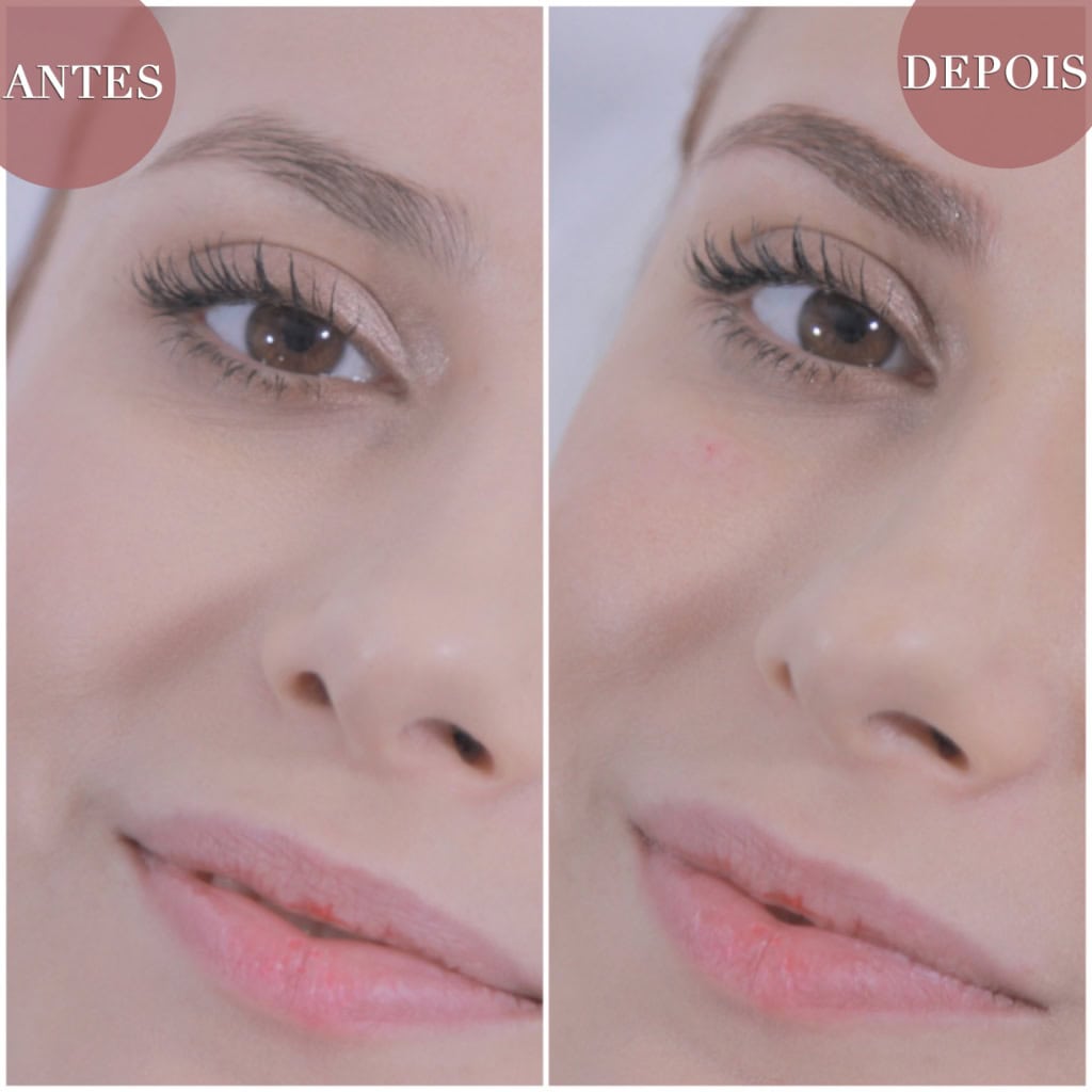 sobrancelha fio a fio realista micropigmentação antes e depois