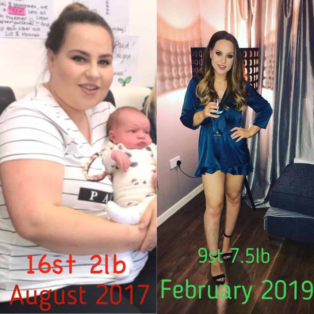 Before and after pictures of Emma at 16 stone and one of her at 9.5 stone