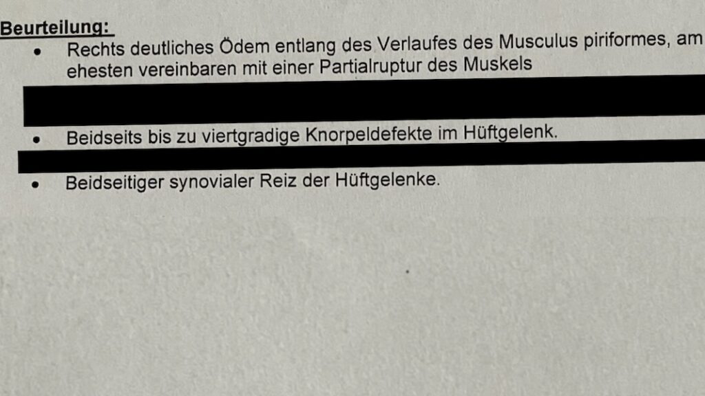 Hueftdysplasie Arthrose MRT Befund