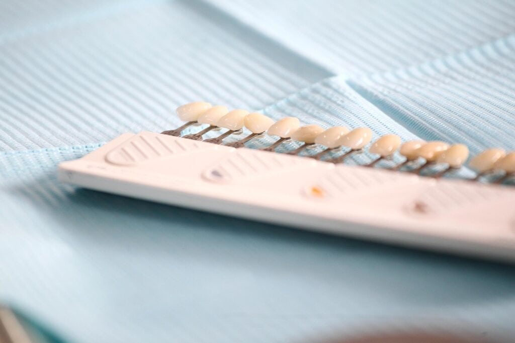 상계동 임플란트 서울열린치과