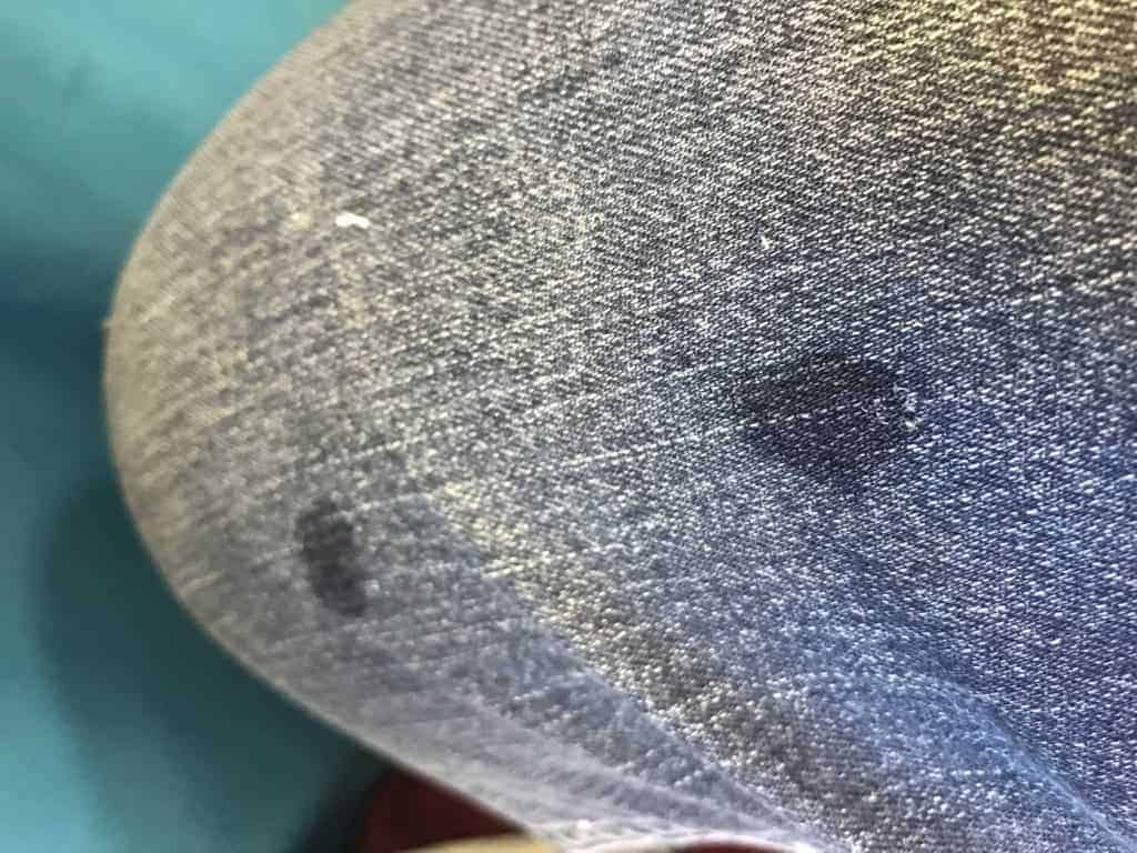 cat drooled on leg