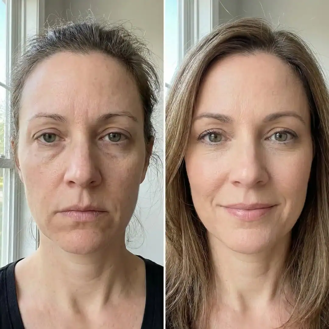 Foto antes y después de tratamiento facial.