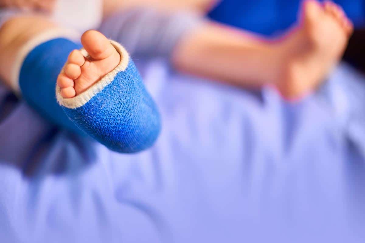 a food in a blue plaster cast due to injury