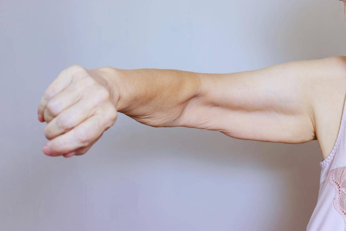 An extended arm with a clenched fist, highlighting skin wrinkles and loose skin, stands out against a plain background.