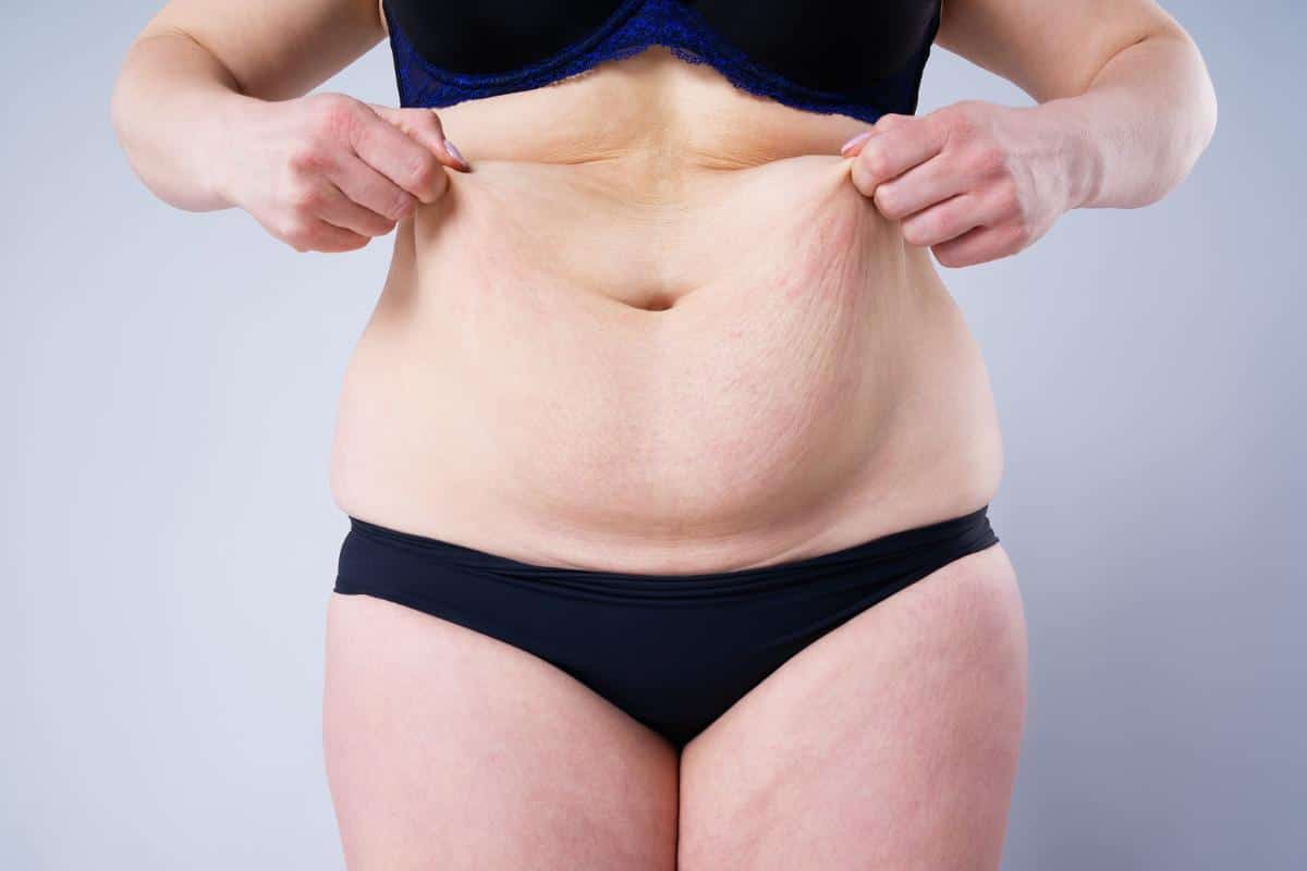 A person wearing black underwear and a dark bra stands against a plain light background, pinching excess skin and fat around their lower abdomen with both hands. Their face is not visible, with the image focusing on their torso and midsection.